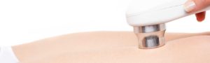 Epilation définitive au laser à Lyon - Dr Corniglion