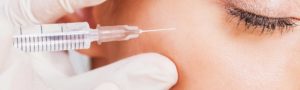 Injection d'acide hyaluronique pour le volume du visage à Lyon - Dr Corniglion