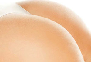 Chirurgie esthétique des fesses à Lyon - Dr Corniglion