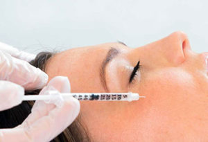 Injection d'acide hyaluronique pour le volume du visage à Lyon - Dr Corniglion