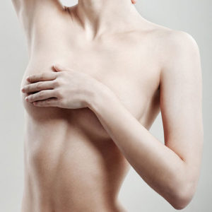 Chirurgie esthétique des seins à Lyon - Mamelon invaginé - Dr Corniglion